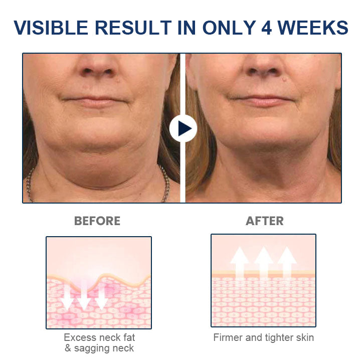 Fivfivgo™ JawFit Pro Face Sculptor