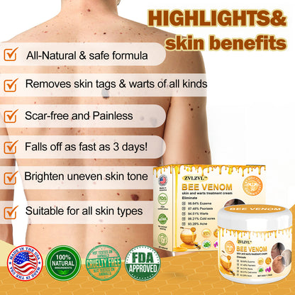 🍃[👨‍⚕AAD RECOMMENDS] ZVLZVL™ Bee Venom Mole and Wart Treatment Cream🔥Limited time 50% OFF🔥( Suitable for use byindividuals of all ages)