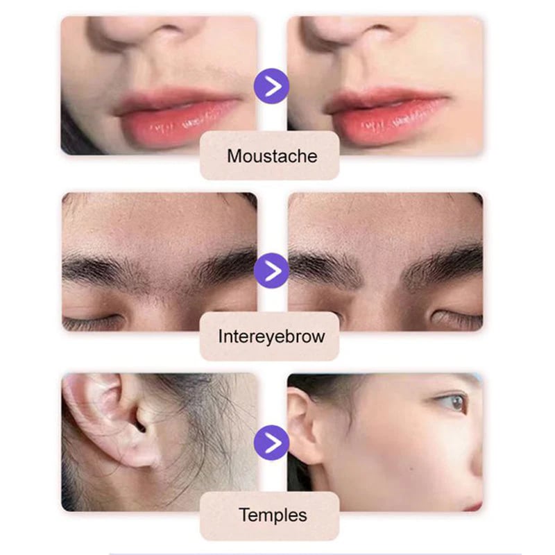 ODEIUN® Gentle and Painless Facial Hair Removal Cream