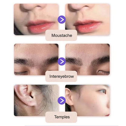 ODEIUN® Gentle and Painless Facial Hair Removal Cream